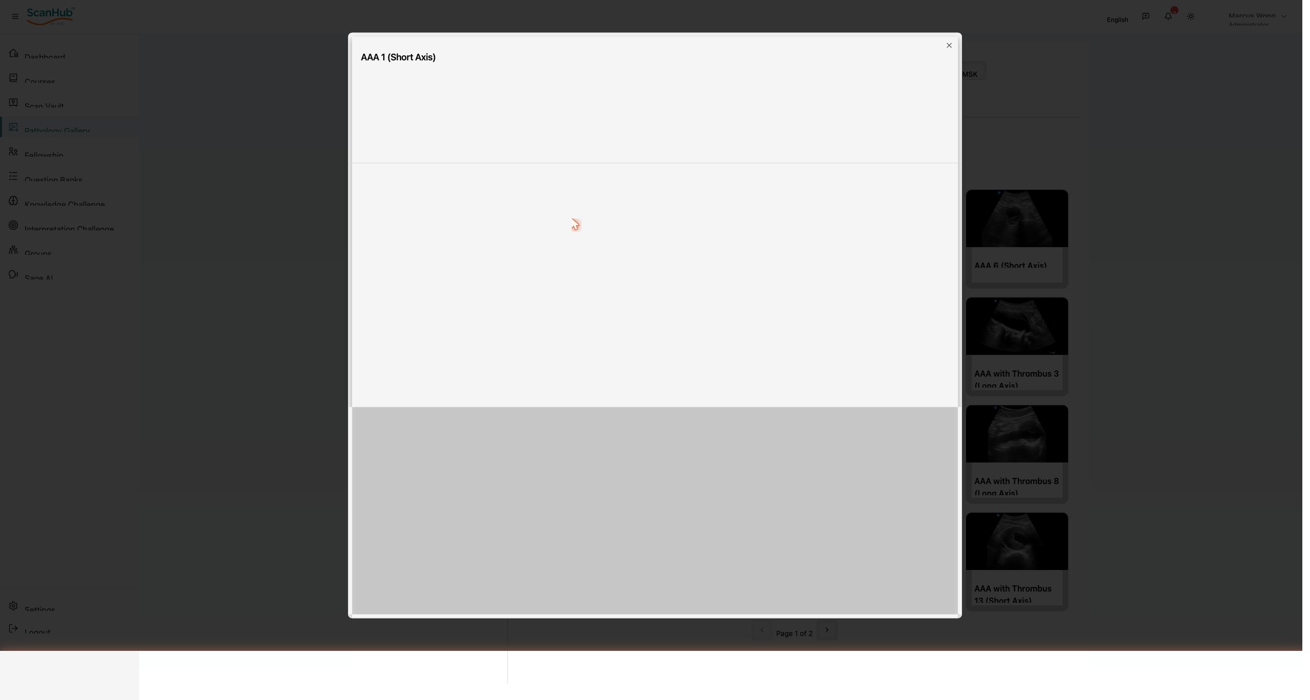 The case viewer